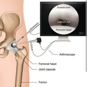 Left Image